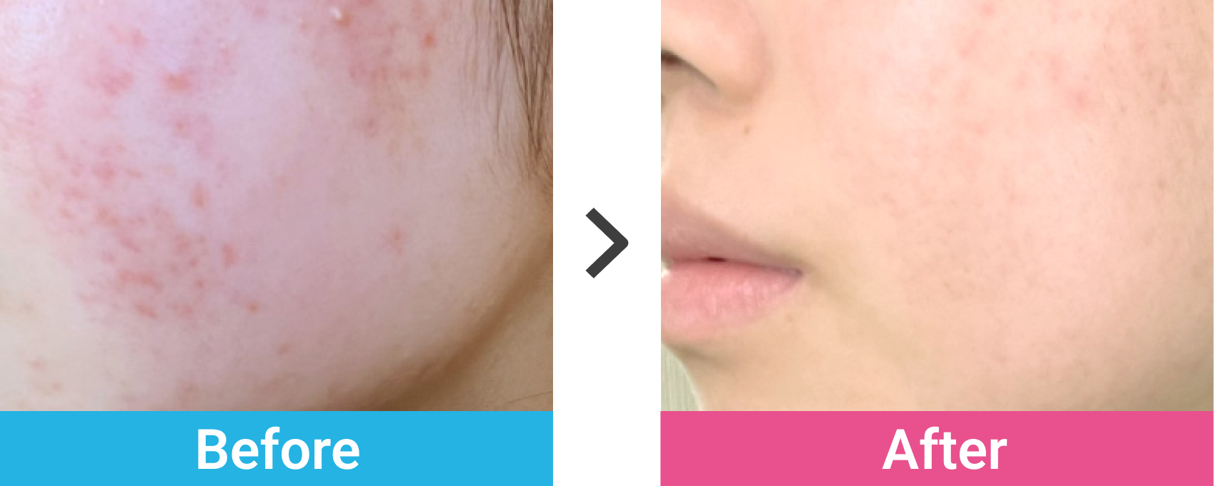 ケース02 Before After