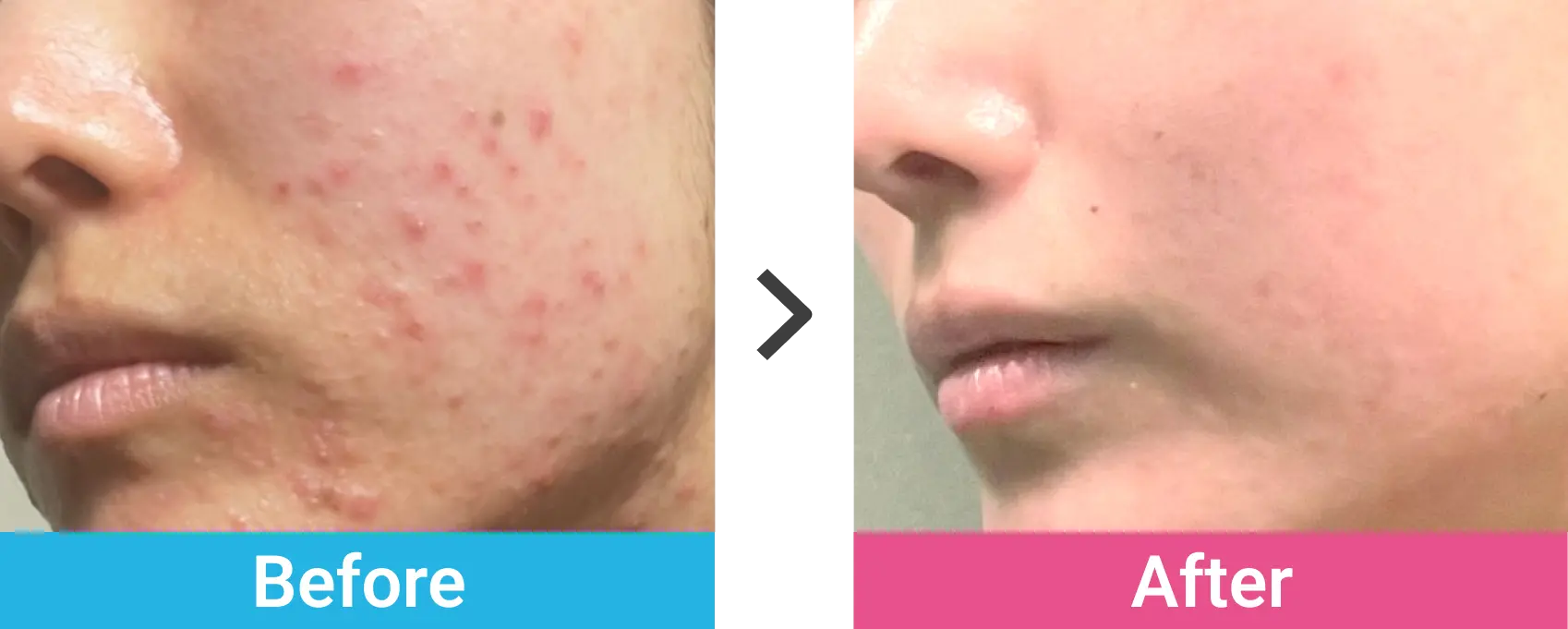 ケース01 Before After