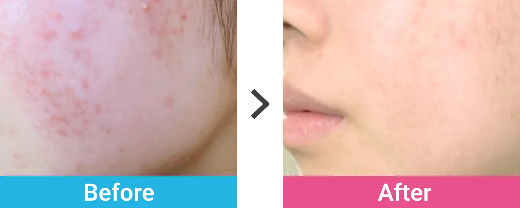 ケース02 Before After