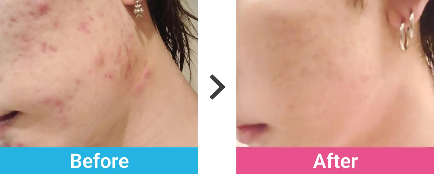 ケース03 Before After